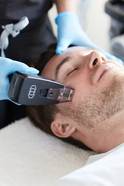 younger man getting laser face treatment