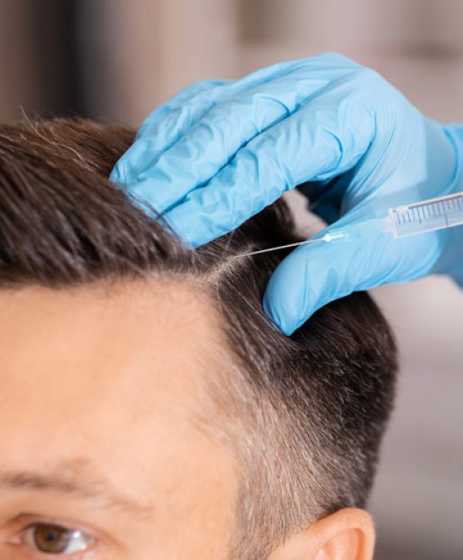 man and PRP hair treatment